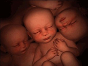 神奇！子宫里面的多胞胎世界(组图)