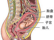胎儿脐血取样全程图解(组图)