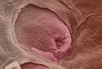 显微镜下人体组织图片(组图)