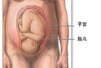 详细图解：剖腹产全过程(组图)