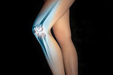5、骨质疏松

美国最近对3683名女性的调查研究发现:体瘦的女性髋骨骨折发生率比标准体重的女性高1倍以上。这还是由于过瘦的人体内雌激素水平不足，影响钙与骨结合，无法维持正常的骨密度，因此容易出现骨质疏松、发生骨折。