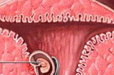 4.人工流产是女性不孕的第二大原因医生发现，流产的次数与发生不孕的几率成正比。多次人工流产易导致盆腔附件炎，输卵管发炎后堵塞，发生不孕。人工流产时的高活性子宫内膜碎片，很容易转移到盆腔内种植形成子宫内膜异位症导致不孕症。而且反复人工流产还会使子宫内膜变得很薄，日后一旦怀孕，胚胎就像沙地里的小苗，得不到充分的养分，容易发育不良、白行流产。（资料图）
