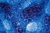 单层分子表面泛起涟漪     这幅照片使用显微镜拍摄，展现了单层分子表面泛起的涟漪。塞斯·达林表示：“这个层实际上由两种不同的分子构成，它们能够将油和水分离开来。在我们拍摄的这幅照片中，这种分离似乎还处在非常早期的阶段。”达林与美国阿贡国家实验室的史蒂文·希班纳合作拍摄了这幅显微照片。照片中的数百万个分子每一个的“头部”都含有硫，但它们尾部所含成分并不相同，其中一种含有碳和氢，另一种含有碳和氟。两种分子的高度相差大约0.2纳米。（来源：凤凰网健康论坛）