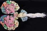 这是使用毛线编制的人脑示意图。（图片来源：凤凰网健康论坛）