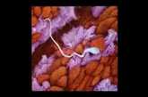 一个精子在输卵管粘膜皱褶内向前游走（来源：凤凰网健康论坛）