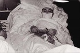 恶劣的天气导致他无法获得医疗援助，Leonid Rogozov做出了一个大胆的决定：自己给自己做手术！1961年4月30日，Leonid Rogozov在队友协助下自己对自己实施了前所未有的一次阑尾切除手术。