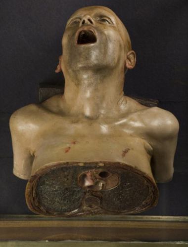 维多利亚时代的人体内脏解剖图(组图)