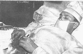 Leonid Rogozov（列昂尼德·罗戈佐夫），一位苏联医生，苏联新拉扎列夫南极科考站驻站医生。1961年4月29日，他感到右髂部位剧痛，同时伴有乏力恶心和发烧症状，他判断自己急性阑尾炎发作。（来源：新华网）