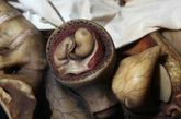 子宫里的胎儿（来源：凤凰网健康论坛）
