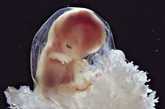 胚胎形成（来源：凤凰网健康论坛）