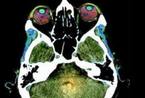 新研究发现人类大脑的七大神奇功能