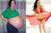 媒体对纳迪娅-苏尔曼的关注还不止这些。苏尔曼在八胞胎破纪录的生产前，体重已达122公斤，产后一年即恢复，体重直线下降至目前的54公斤。