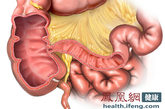 　信号二：腹痛和腹胀：肠癌患者因肠道梗阻而出现腹胀、腹痛。疼痛的部位多在中下腹部，程度轻重不一，多为隐痛或者胀痛。