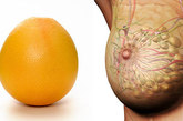 葡萄柚——乳房 　　柑橘类水果长得像乳腺，橘子的抗氧化剂含量是所有水果中最高的，含170多种不同的植物化学成分。食用时橘络不要扔掉，可缓解乳腺增生症状。 
