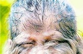狼人综合症：人体的体毛达到多少才被认为是反常现象呢？对于狼人综合症患者而言，他们几乎身体的每一寸肌肤都会长着茂密的毛发。甚至当接受激光治疗之后，毛发还会茂盛地蔓延至全身，目前全球有50人患有狼人综合症。（图片来源：光明网）

