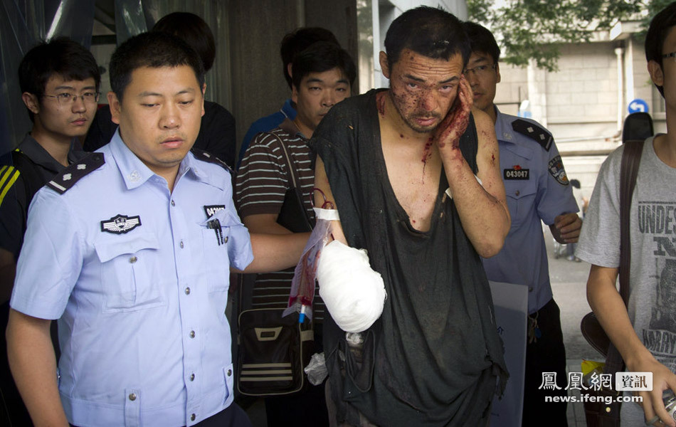 北京南三环发生爆炸案嫌犯右手被炸掉