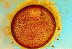 医学摄影：显微镜下的人工受精(组图)