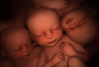子宫里面的多胞胎世界(组图)