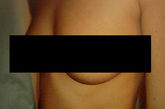 整形外科医生公开欠费客户裸照    一名德国整形外科医生专门寻猎那些拒不支付手术费用的女病人，并公开发表她们的裸照，这些照片可能是历史上最具有影响力的海报了，因为他发表了她们隆胸后的照片。
