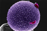 带有冠细胞的人类卵子。这张彩色图片上的紫色人类卵子坐落在一个柱状物上。它上面包裹一层透明带状物——醣蛋白，这种物质既具有保护卵细胞的作用，又能诱捕和限制精子。两个红色冠细胞粘贴在透明带状物上。（文/凤凰网健康综合，图/资料图） 
