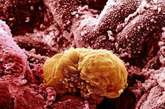 培育6天后的人类胚胎被植入子宫。生命循环从此开始：6天的人类胚胎开始被植入子宫内膜——子宫的内表面。（文/凤凰网健康综合，图/资料图） 

