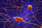普尔基涅神经元。在大脑里的1000亿个神经元中，普尔基涅神经元是体积最大的。这些细胞是小脑皮层里的运动协调大师。接触酒精、锂等有毒物质、患有自身免疫性疾病、存在孤独症和神经退行性疾病 (Neurodegenerative disease)等遗传变异，都会对人类的普尔基涅神经元造成消极影响。（文/凤凰网健康综合，图/资料图） 
