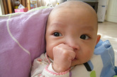 党庆因（男），2011年6月1日生，患唇腭裂（Ⅲ） 

