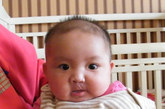 周欣慧（女），2011年5月20日生，来自河南，唇腭裂,已进行一次手术