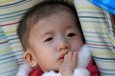 王路德（女），2010年7月31日生，来自河北，左右脸发育不均衡

