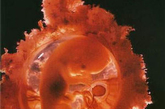 泡着床后其细胞继续进行分化，形成三个胚层：外胚层、中胚层及内胚层，并相应地在不同的孕周发育成为胎儿的各个组织及器官。