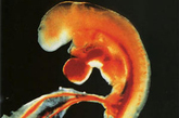 受精后8天。胚牙完成“着陆”,微微嵌入子宫内膜。此时它分裂发育为几百个细胞