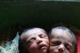8月26日在孟加拉国杰索尔一家医院拍摄的名叫基伦的双头男婴。这名男婴是于25日经过剖腹产手术降生的，体重5.5公斤。
