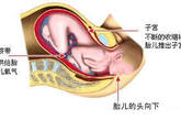 第二产程(胎儿娩出期)：指从子宫口开全到胎儿娩出。 初产妇约需1～2小时，经产妇较快，但也有长达1小时者。为达到经阴道自然分娩，胎头在下降过程中必须不断适应产道径线的变化，为达到这一目的，儿头位置按以下顺序产生一系列的变化：俯曲、内旋转(胎头旋转90°，枕骨朝前)、仰伸、复位及外旋转。这些过程主要发生在第一产程末和第二产程。 
