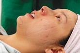 手术后，鼻梁是直了，由于过程恐怖，吴文忻忍不住哭。
