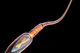 2.无精子症：在三次精液检查的结果中，都没有发现精子的患者就被称为无精症。

