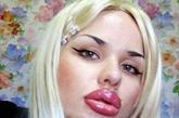 俄罗斯少女Kristina Rei对于硅胶植入嘴唇收入陷入痴迷状态。曾经是少年的时候，她就觉得自己的的薄嘴唇没有吸引力。就在她到了年龄，可以进行硅胶植入手术的时候，她迅速的将自己的嘴唇变厚。她希望自己能够变成世界上最后的嘴唇