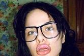 俄罗斯少女Kristina Rei对于硅胶植入嘴唇收入陷入痴迷状态。曾经是少年的时候，她就觉得自己的的薄嘴唇没有吸引力。就在她到了年龄，可以进行硅胶植入手术的时候，她迅速的将自己的嘴唇变厚。她希望自己能够变成世界上最后的嘴唇