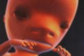 第四个月(12—15周)，胎儿身长已达16厘米，体重约120克，生长迅速。胎头与身体的比例不那么悬殊了，腿相对变长，骨骼迅速骨化。
