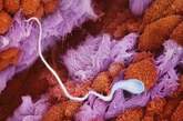 受孕：一个精子游向输卵管黏液膜褶内的一个卵子。（图片来源：光明网）

