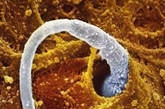 受孕：一个精子游向输卵管黏液膜褶内的一个卵子。
