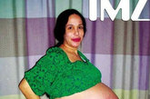 纳迪娅-苏尔曼是全世界都在关注的一位母亲。她33岁，单身，失业，在2009年1月26日依靠人工授精，产下美国历史上惟一全部存活的8胞胎，6个男孩，2个女孩。这一事件曾轰动美国。（图片来源：家庭医生在线）
