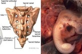 尾椎骨，也成为尾骨，是人类椎骨的最后一个部分，也可以说是人类失去的尾巴的残余。实际上，地球上几乎所有的哺乳动物都或多或少有带着尾巴的影子，即使是在子宫发育的时候。对于人类来说就是如此。人类胚胎发育的某些阶段，可以很清楚的看出有尾巴形状的组织。