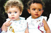 肤色差别最大的双胞胎—黑白双胞胎

这对黑白双胞胎今年5月在澳大利亚出生。她们34岁的父亲辛格尔是一个纯正的白人，35岁的母亲奈特则是牙买加和英国的混血儿。这对双胞胎一个叫艾丽西娅，一个叫贾斯曼。艾丽西娅继承了妈妈的特征，皮肤黝黑，有一双棕色的眼睛，头发是深色的；贾斯曼则像爸爸一样拥有白色的皮肤，头发也是白色的，有一双蓝眼睛。

 
