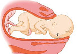 即使不用力也能看到胎儿的头，胎儿的头通过骨盆，面部对着妈妈的后背。等阵痛消失的时候，胎儿的头就出来了。胎儿的头压住会阴，会阴像纸一样薄。
