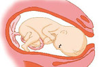 看看胎儿临产前的样子(组图) 