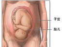 详细图解：剖腹产全过程(组图)