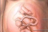 在妊娠后期，胎儿在子宫内呈头低位（资料图）