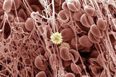  血液凝块 还记得你刚刚看到的形状统一的红血球图片吗?这张图看起来像是红血球粘在了粘性网上，形成血液凝块。位于中间的那个细胞是白血球。