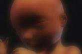 第八个月(28—31周)，胎儿身长约40厘米，体重约1700克。胎儿在子宫内活动自由，胎动协调，位置基本固定，一般头部朝下。神经系统进一步完善，肺及其它内脏已基本发育完成。这时出生的早产儿，如在暖箱里精心照料，已能存活。第九个月(32—35周末)，胎儿约45厘米长，体重在4周内可以增加1000克，发育基本完成。这时出生的早产儿如果能精心照顾，成活率可达90%以上。第十个月(36—40周)，胎儿发育完成，约50厘米长，3000克重。皮肤呈白色微带粉红色，体表有一层白色的脂肪，胸部发育良好，双乳凸出，会打嗝、会吮自己的拇指，男性睾丸常位于阴囊内。
