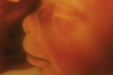 第五个月(16—19周)，孕妇就会感觉腹内胎儿在踢自己以显示他的存在，这就是胎动。胎儿传来的另一个信息是可以在腹部听到胎心音，一般为120—160次/分。胎儿已具备听力，能听见声音，可开始进行胎教了。此时胎儿体长约25厘米，重500克。
